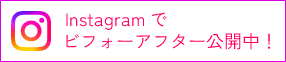 Instagramでビフォーアフター公開中！